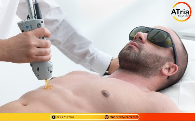 لیزر موهای زائد آقابان