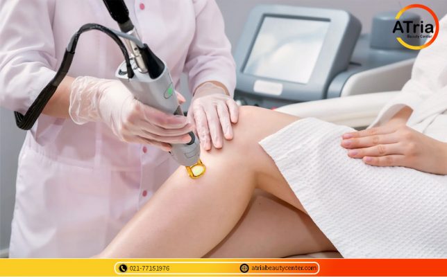 لیزر موهای زائد بانوان